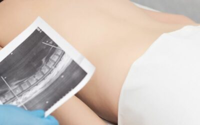 Avoid These Exercises When Dealing with Spondylolisthesis