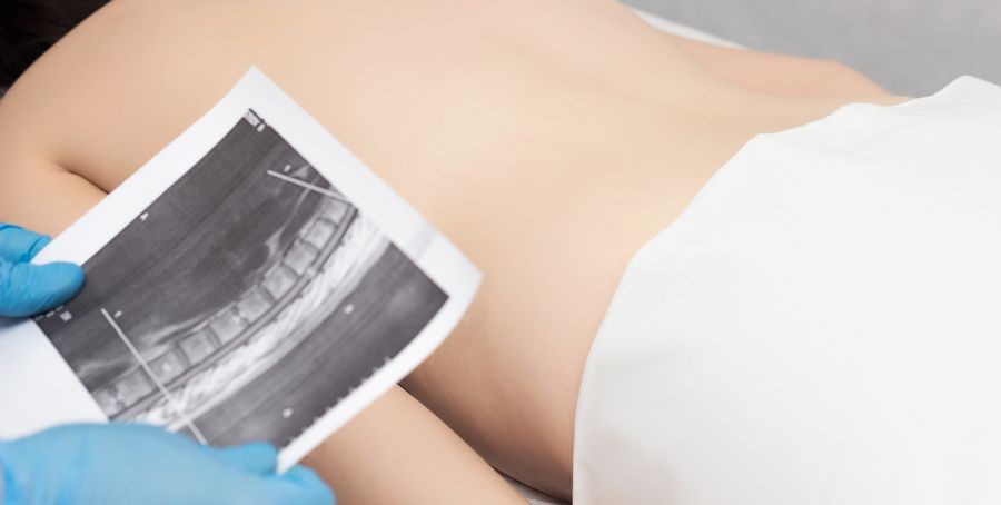 Avoid These Exercises When Dealing with Spondylolisthesis