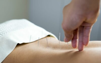 Acupuncture for Slipped Discs: A Comprehensive Guide