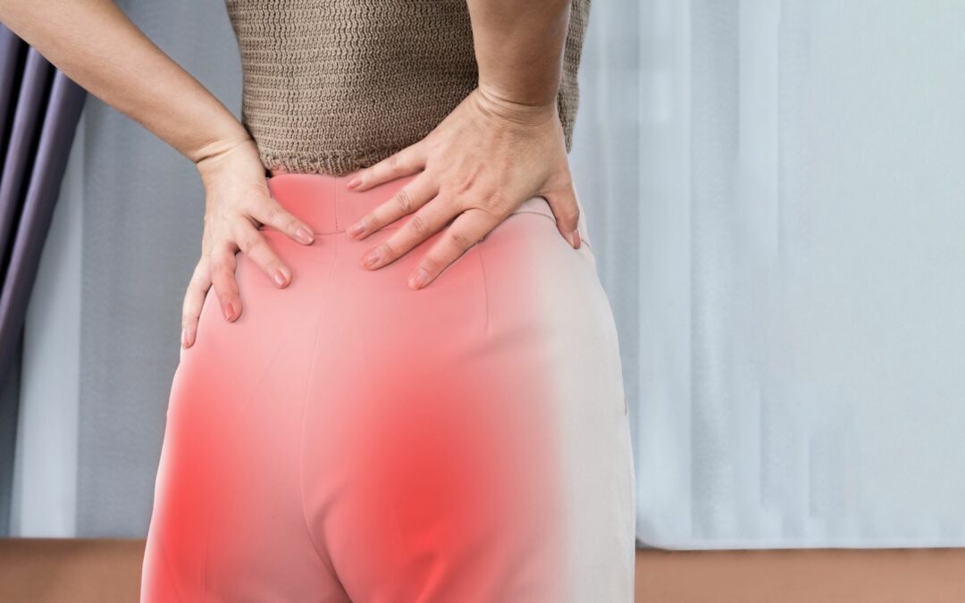 10 Natural Remedies for Sciatica Pain Relief