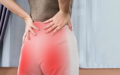 10 Natural Remedies for Sciatica Pain Relief