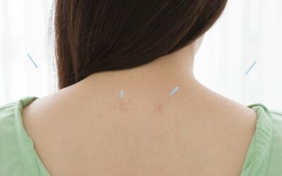 The Effectiveness of Acupuncture for Rheumatoid Arthritis