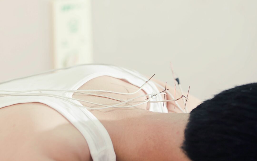 Treating Neck Pain with Acupuncture: A Comprehensive Guide