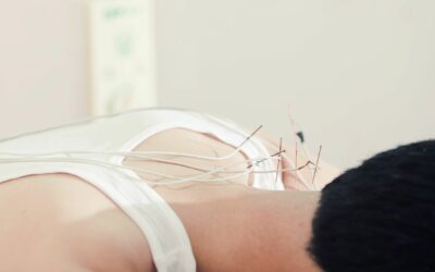Treating Neck Pain with Acupuncture: A Comprehensive Guide