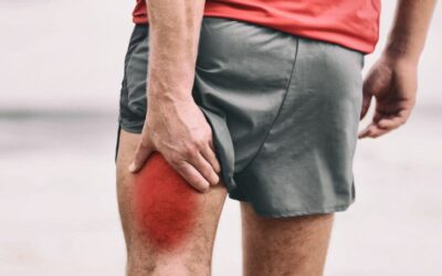 A Traditional Chinese Medicine Approach to Muscle Sprains