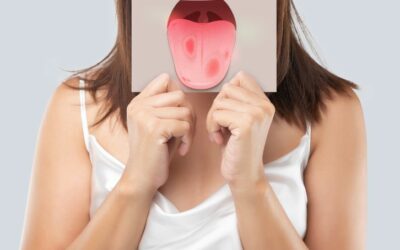 Understanding Tongue Crack in Traditional Chinese Medicine (TCM)