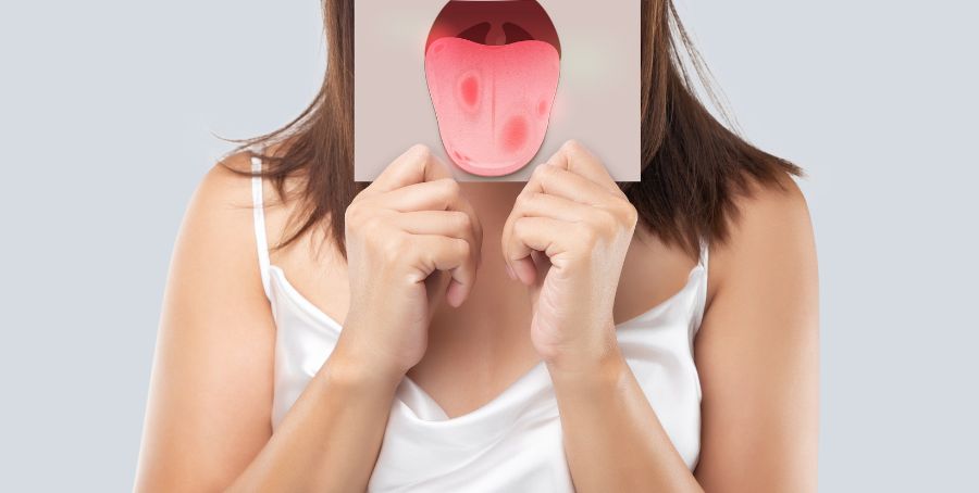 Understanding Tongue Crack in Traditional Chinese Medicine (TCM)