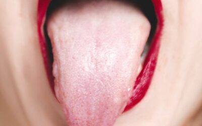 Understanding Scalloped Tongue in Traditional Chinese Medicine