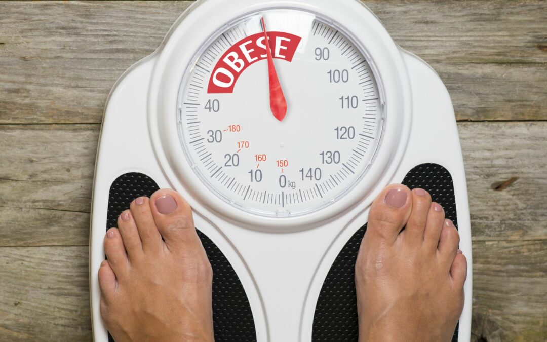 Prevent Obesity with Traditional Chinese Medicine (TCM): Effective Strategies