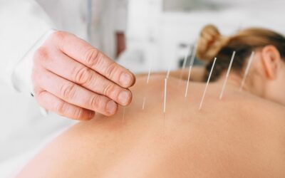 The Effectiveness of Acupuncture for Shingles: A Comprehensive Guide