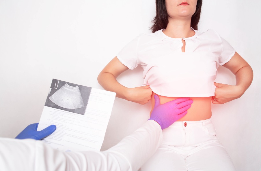 Chinese Herbs for Fatty Liver: A Natural Remedy for Liver Health