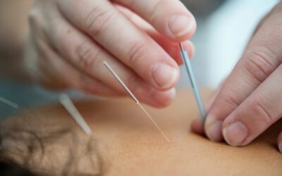 Comparing Acupuncture and Western Medicine