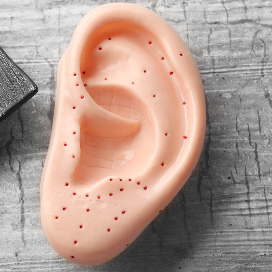 Ear Seeds: About This Acupressure Technique