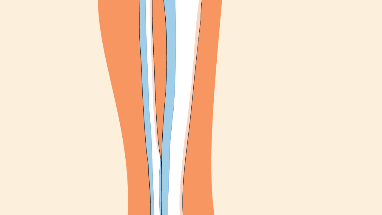 Having Knee Pain? 5 Home Remedies for Knee Arthritis Singapore