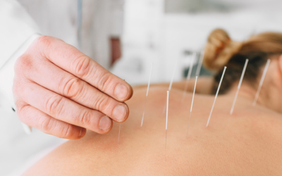 Is Acupuncture Beneficial for Stroke Patients?