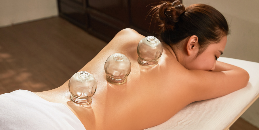 cupping