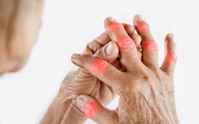 手指僵硬不是“小毛病”，尽早调理重拾灵活双手